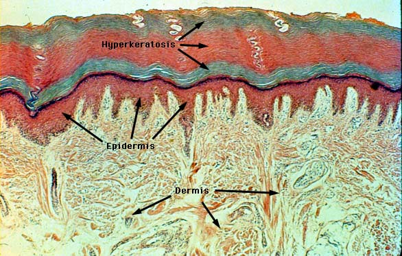 Histologi Kulit Dr Zulaika Nur Afifah